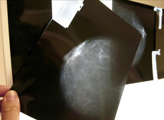La Sociedad Americana del Cáncer aconseja menos mamografías y más tarde
